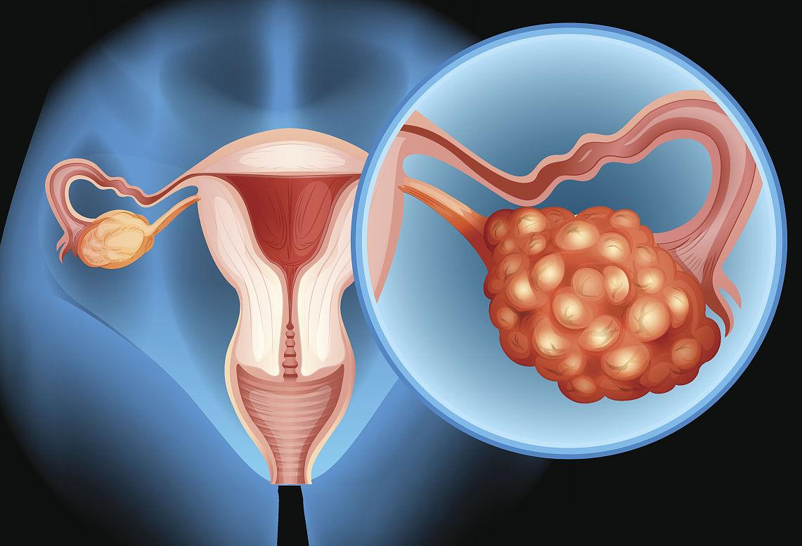27岁卵巢早衰怎么调理&和睦优生供卵试管,男性不育的常见病因