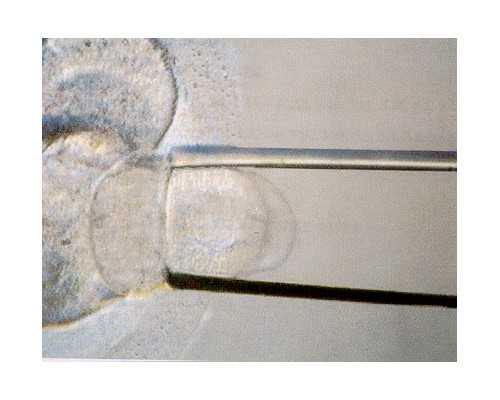 郑州试管供卵医院最新排名助你精准选择