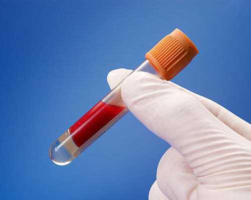 试管治疗中黄体功能异常的预警信号