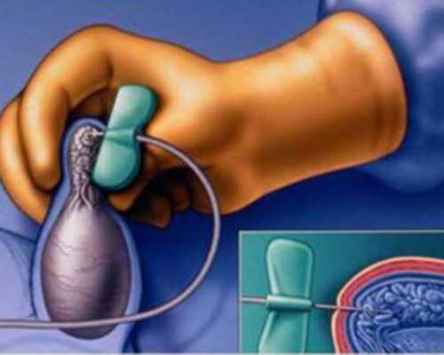 北京四代试管的成功率展望：未来可期的生育希望