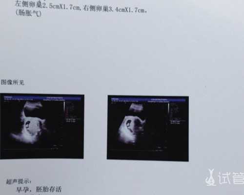 试管妈妈黄体功能保养食疗方案