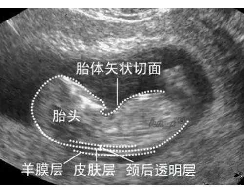 郑州试管婴儿助孕医院成功率对比，如何正确选择医院.