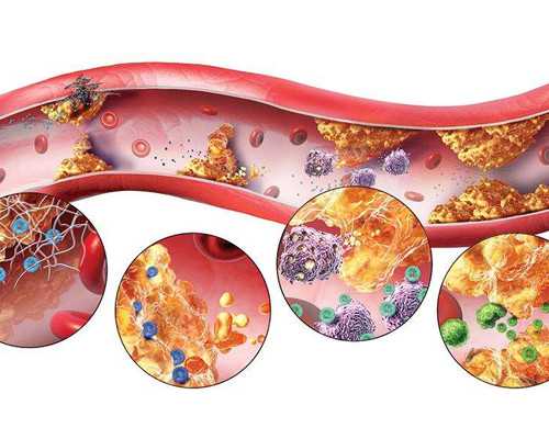 试管移植后防畸关键措施