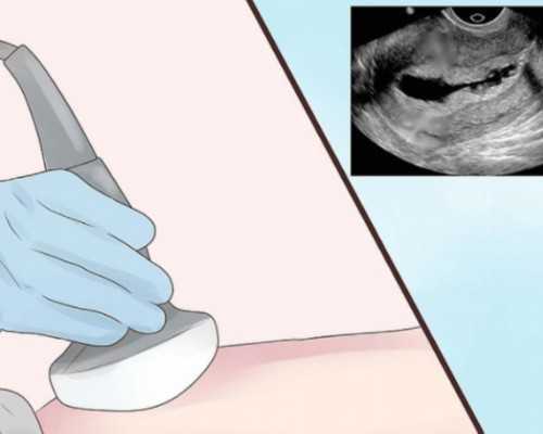 精子活力与受孕率