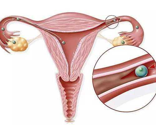 试管周期黄体功能动态评估方法