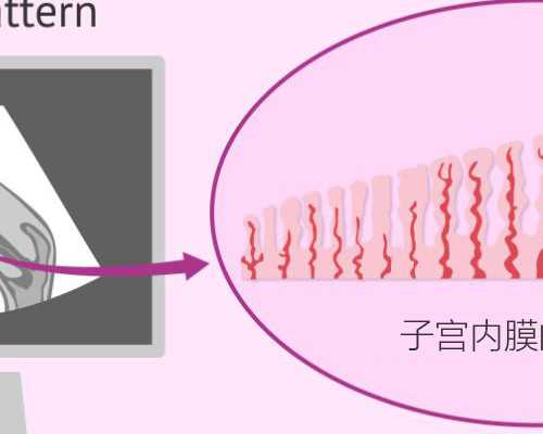 45岁高龄供卵试管一次成功经验