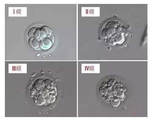 剖析试管婴儿费用：让你明明白白做治疗