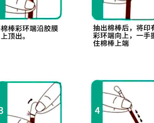 试管知识:黄体功能不全的遗传因素探究