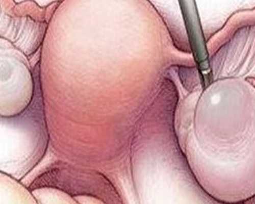 试管精子筛选标准