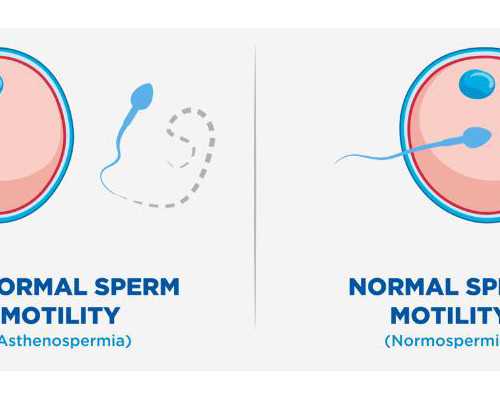 试管知识:不同体质患者的黄体支持方案差异