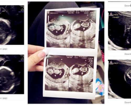 试管精子质量提升技巧