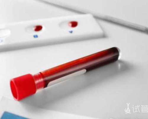 北京四代试管的研究进展：不断推动生殖医学的进步