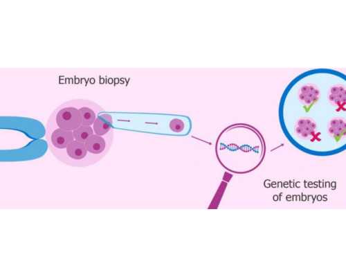 高龄试管患者黄体支持注意事项