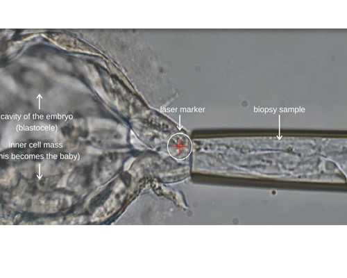 试管精子处理技术介绍